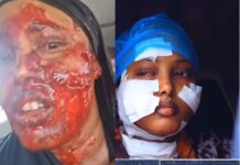 Visa Denial Triggers Attack on Somali-Dutch Woman in Mogadishu