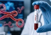 Hay’ada Caafimaadka Aduunka Oo Ka Digtay Faafitaanka cudurka Ebola
